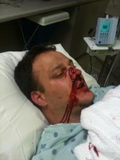 ouchpicture.jpg ouchpicture.jpg